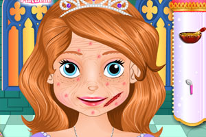 索菲亚的脸部治疗