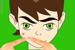 少年骇客挤痘痘