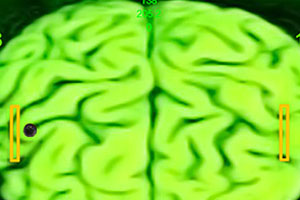 左右脑弹球大战