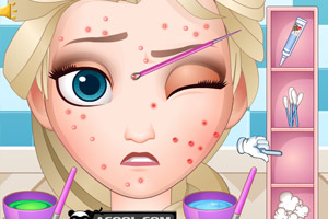 冰雪女王挤痘痘