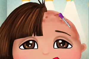 小朵拉治疗脱发