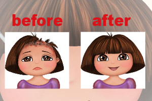 小朵拉治疗脱发