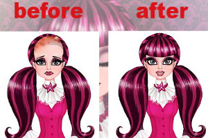 德库莱拉治脱发