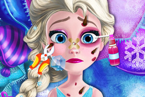 艾尔莎又受伤了