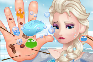 为艾尔莎治疗双手