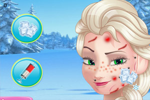 艾尔莎看皮肤病