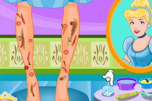 灰姑娘腿受伤了