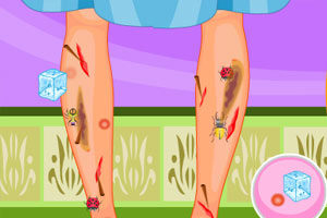 灰姑娘腿受伤了