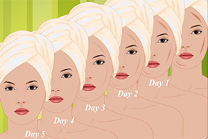 面部疤痕自然护理